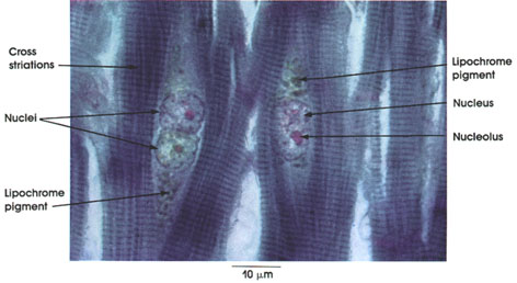 Plate 5.80: Cardiac Muscle