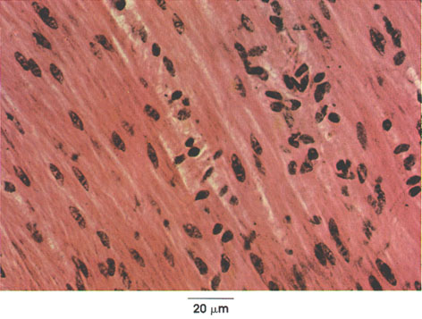 Plate 5.81: Smooth Muscle