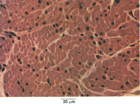 Plate 5.82: Smooth Muscle