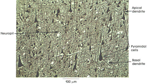 Plate 6.85 Cerebral Cortex: Motor area, Precentral region