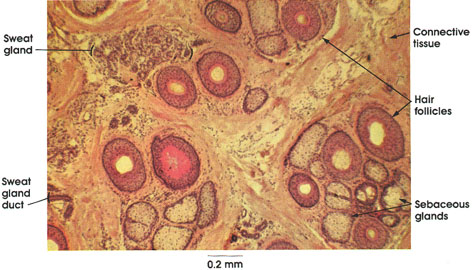 Plate 7.146 Scalp: Cross Section