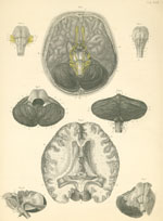 Plate 23: Brain and cerebellum.
