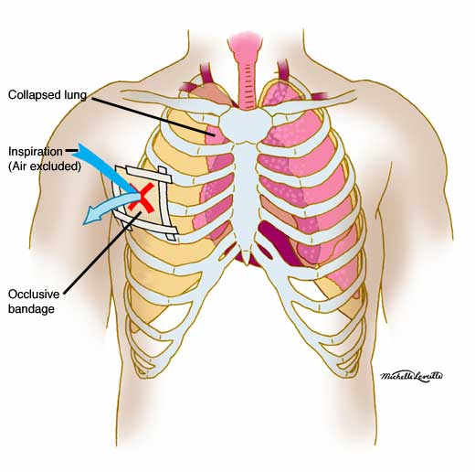 Anatomy Atlases: Anatomy of First Aid: A Case Study ...